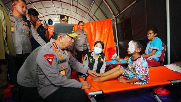  Kapolri Jenguk Anak Korban Erupsi Lewotobi di Posko Kesehatan Pengungsian